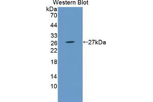 Image no. 1 for anti-Recoverin (RCVRN) (AA 2-200) antibody (ABIN5014254)