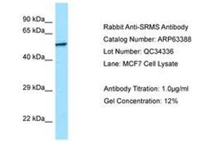 Image no. 1 for anti-Src-Related Kinase Lacking C-Terminal Regulatory Tyrosine and N-Terminal Myristylation Sites (SRMS) (C-Term) antibody (ABIN6749978)