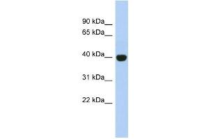 Image no. 1 for anti-KIAA1191 (KIAA1191) (Middle Region) antibody (ABIN632888)