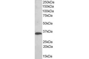 Image no. 2 for anti-Thioredoxin-Related Transmembrane Protein 1 (TMX1) (C-Term) antibody (ABIN184598)