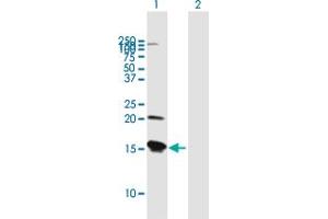 anti-Vesicle-Associated Membrane Protein 8 (Endobrevin) (VAMP8) (AA 1-100) antibody