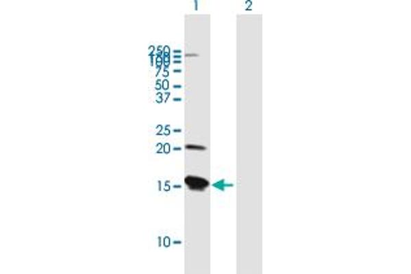 anti-Vesicle-Associated Membrane Protein 8 (Endobrevin) (VAMP8) (AA 1-100) antibody