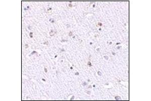 Immunohistochemistry of Nanos1 in human brain tissue with this product at 2.