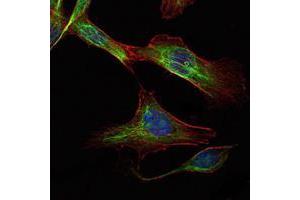 Image no. 2 for anti-RPTOR Independent Companion of mTOR, Complex 2 (RICTOR) antibody (ABIN969382)