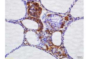 Image no. 1 for anti-Nicotinamide Nucleotide Transhydrogenase (NNT) (AA 981-1086) antibody (ABIN709631)
