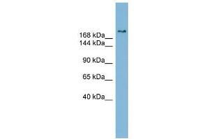 Image no. 1 for anti-SET Binding Protein 1 (SETBP1) (Middle Region) antibody (ABIN927775)