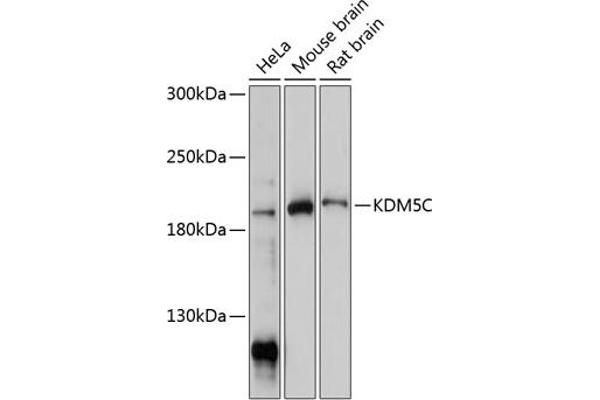 KDM5C Antikörper  (C-Term)