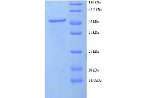 Image no. 1 for Charged Multivesicular Body Protein 2A (CHMP2A) (AA 1-222), (full length) protein (GST tag) (ABIN1046808)