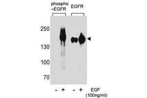 Image no. 2 for anti-Epidermal Growth Factor Receptor (EGFR) (pTyr1172) antibody (ABIN3030845)