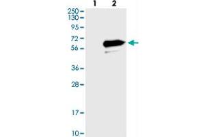 Image no. 2 for anti-Leucine Rich Repeat Containing 14 (LRRC14) antibody (ABIN5582726)