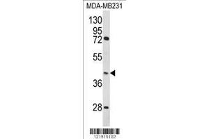 Image no. 1 for anti-Homer Homolog 3 (Drosophila) (HOMER3) (AA 281-308) antibody (ABIN652274)