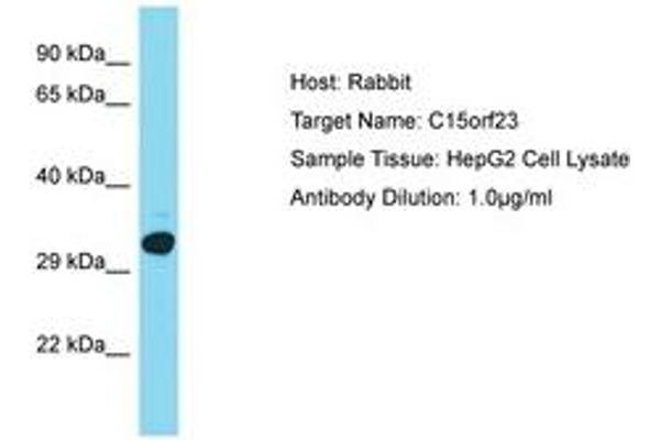 anti-Kinetochore-Localized Astrin/SPAG5 Binding Protein (KNSTRN) (AA 151-200) antibody