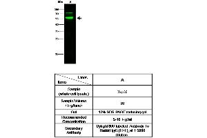 Image no. 2 for anti-Alpha2 Antiplasmin (SERPINF2) (AA 1-491) antibody (ABIN1996315)