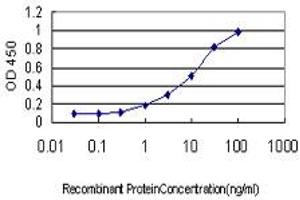 Image no. 1 for anti-Presenilin Enhancer 2 Homolog (PSENEN) (AA 1-101) antibody (ABIN565943)