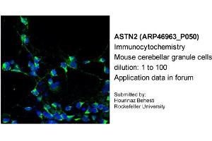Image no. 2 for anti-Astrotactin 2 (ASTN2) (N-Term) antibody (ABIN2782800)