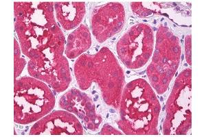 Image no. 1 for anti-Serotonin Receptor 3B (HTR3B) (Internal Region) antibody (ABIN1514854)