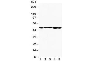 Image no. 2 for anti-Hepatitis A Virus Cellular Receptor 1 (HAVCR1) (AA 289-307) antibody (ABIN3031182)