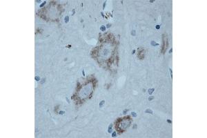 Image no. 12 for anti-Solute Carrier Family 18 (Vesicular Acetylcholine), Member 3 (SLC18A3) (AA 450-505) antibody (ABIN351375)