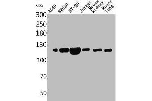 CD133 anticorps  (N-Term)