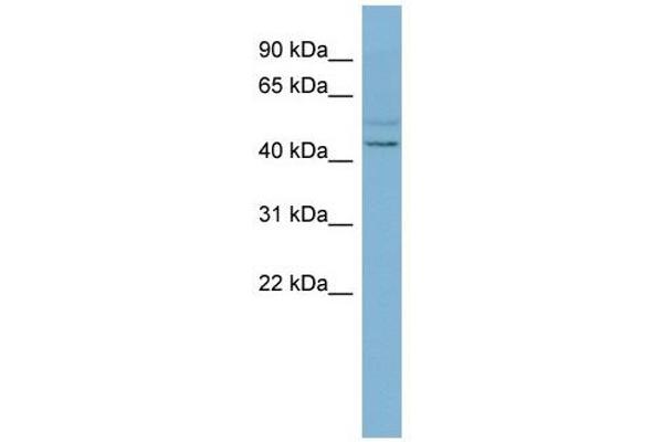 SLC46A1 anticorps