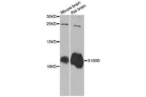 Image no. 2 for anti-S100 Calcium Binding Protein B (S100B) (pSer100) antibody (ABIN3021048)