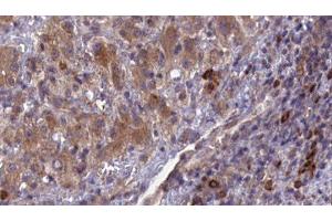 Image no. 3 for anti-Cell Adhesion Molecule 1 (CADM1) antibody (ABIN6260400)
