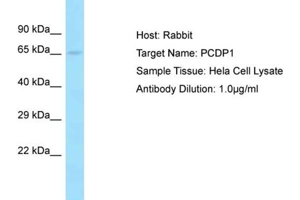 anti-Primary Ciliary Dyskinesia Protein 1 (PCDP1) (C-Term) antibody