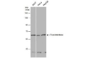 Image no. 4 for anti-Transketolase (TKT) (Internal Region) antibody (ABIN2855058)