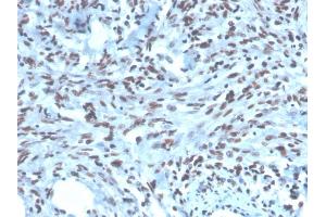 Image no. 5 for anti-Paired Box Gene 2a (PAX2A) (AA 223-354) antibody (ABIN6940252)