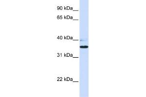 Image no. 1 for anti-UDP-Gal:betaGlcNAc beta 1,3-Galactosyltransferase, Polypeptide 1 (B3GALT1) (N-Term) antibody (ABIN2783816)