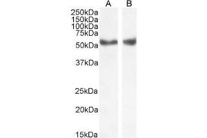 Image no. 1 for anti-Nuclear Receptor Subfamily 1, Group H, Member 2/3 (NR1H2/3) (Internal Region) antibody (ABIN185294)