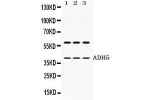 Image no. 1 for anti-Alcohol Dehydrogenase 5 (Class III), chi Polypeptide (ADH5) (AA 212-374) antibody (ABIN4886429)