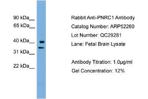 Image no. 1 for anti-Proline Rich Nuclear Receptor Coactivator 1 (PNRC1) (Middle Region) antibody (ABIN2784848)
