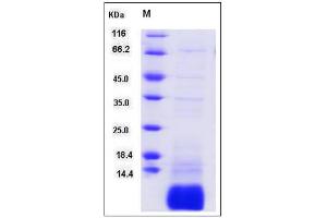 Image no. 1 for G Protein gamma Transducing Activity Polypeptide 1 (GNGT1) (Mature), (AA 2-71) protein (His tag) (ABIN2005844)