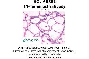 Image no. 1 for anti-Adrenergic, beta-3-, Receptor (ADRB3) (Extracellular Domain), (N-Term) antibody (ABIN1731586)