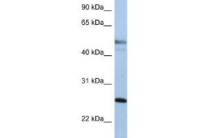 Image no. 5 for anti-Keratin 8 (KRT8) (Middle Region) antibody (ABIN2777113)