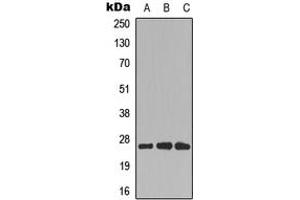 Image no. 2 for anti-Cell Division Cycle Associated 4 (CDCA4) (Center) antibody (ABIN2972927)