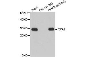 Image no. 3 for anti-Replication Protein A2, 32kDa (RPA2) antibody (ABIN3023166)