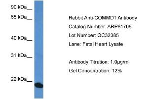 Image no. 1 for anti-Copper Metabolism (Murr1) Domain Containing 1 (COMMD1) (C-Term) antibody (ABIN2788874)