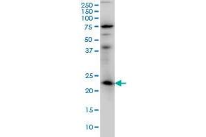 Image no. 2 for anti-RAB3A, Member RAS Oncogene Family (RAB3A) (AA 122-220) antibody (ABIN562556)