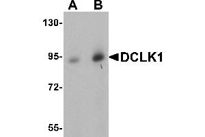 Image no. 2 for anti-Doublecortin-Like Kinase 1 (DCLK1) (N-Term) antibody (ABIN1031345)