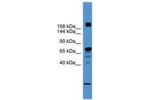 Image no. 1 for anti-Rearranged L-Myc Fusion (RLF) (AA 20-69) antibody (ABIN6745418)