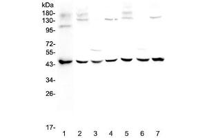 Image no. 4 for anti-WW Domain Containing Oxidoreductase (WWOX) antibody (ABIN5708495)