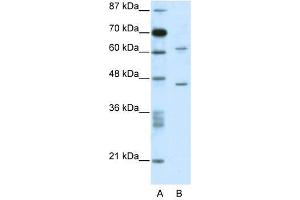 Image no. 1 for anti-TRM1 tRNA Methyltransferase 1-Like (TRMT1L) (N-Term) antibody (ABIN927280)