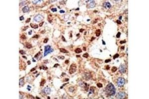 Image no. 4 for anti-Promyelocytic Leukemia (PML) (AA 470-499), (Sumoylation Site) antibody (ABIN3032330)