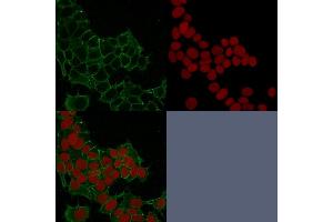 Image no. 2 for anti-Junction Plakoglobin (JUP) antibody (ABIN6939838)