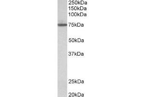 Image no. 1 for anti-Transglutaminase 4 (Prostate) (TGM4) (AA 49-63) antibody (ABIN870645)