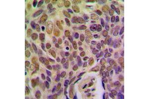 Image no. 1 for anti-Breast Cancer Metastasis Suppressor 1 (BRMS1) (Center) antibody (ABIN2705613)