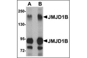 Image no. 2 for anti-Lysine (K)-Specific Demethylase 3B (KDM3B) (Center) antibody (ABIN500076)
