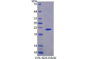 Image no. 2 for phosphorylase, Glycogen, Liver (PYGL) ELISA Kit (ABIN6574226)